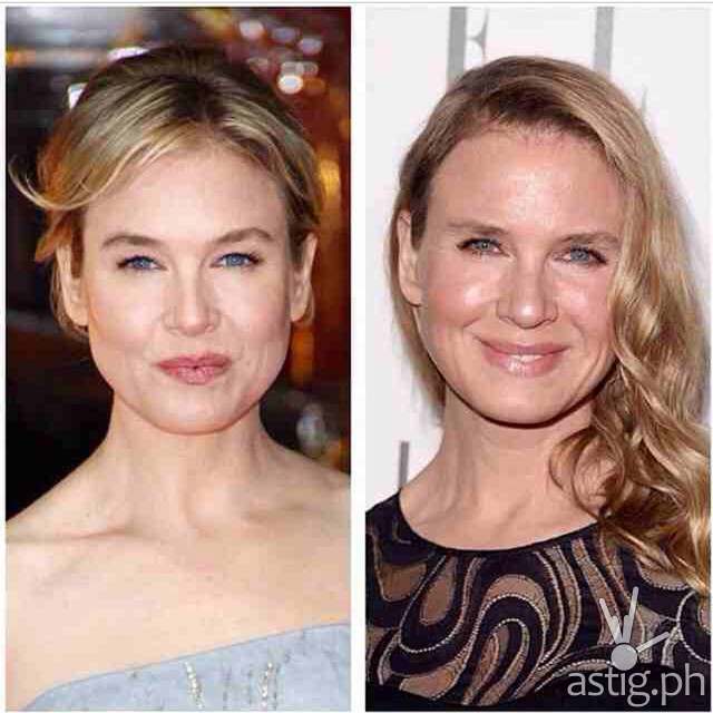 Renee Zellweger before and after